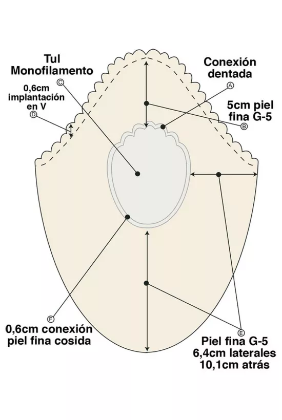 Protesis Capilar HORUS Protesis Capilar HORUS