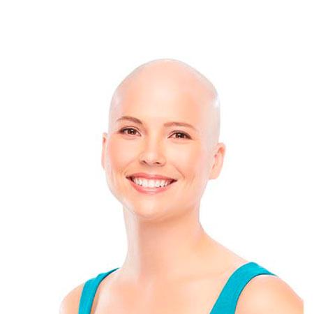 Pelucas Oncologicas